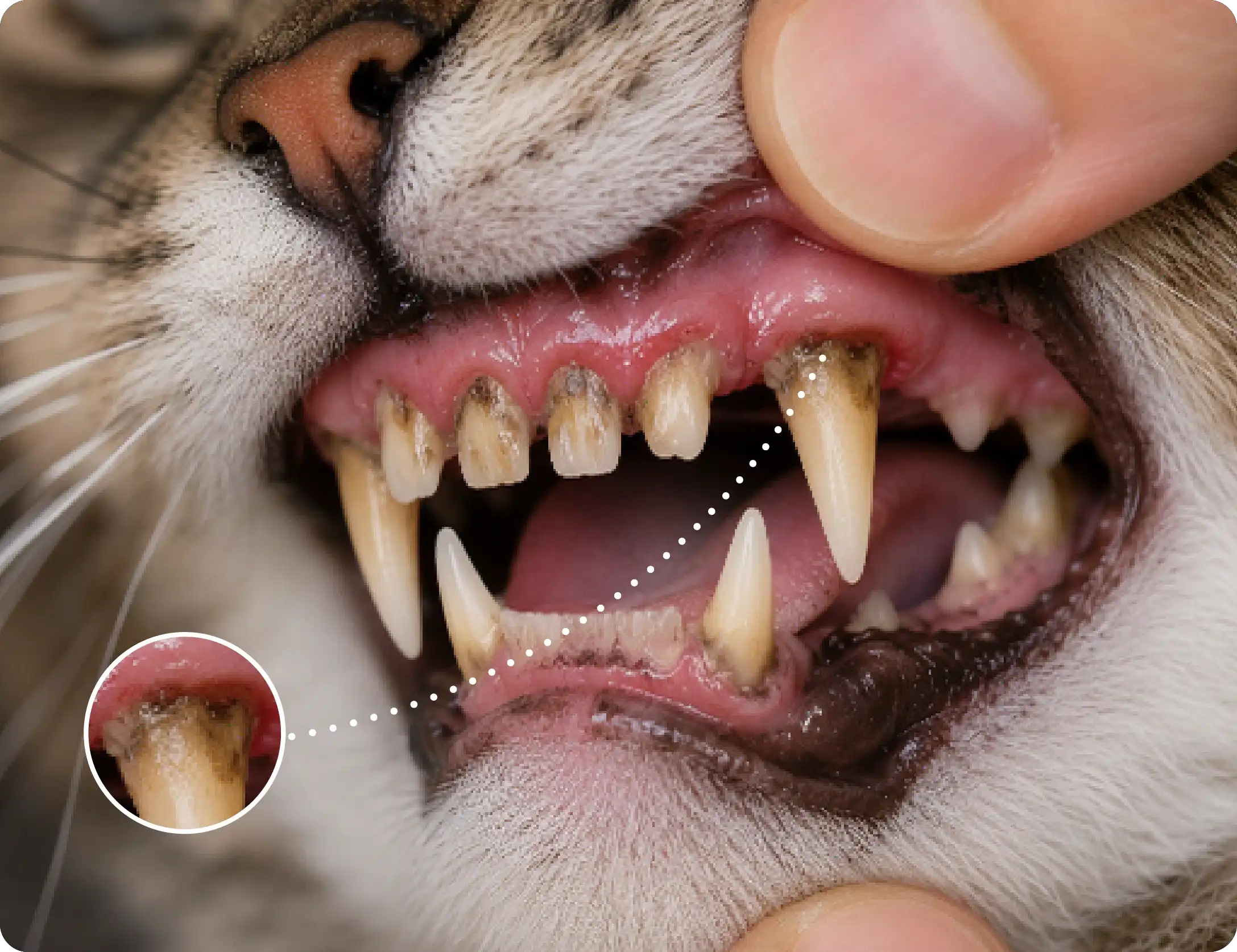 Dental Disease